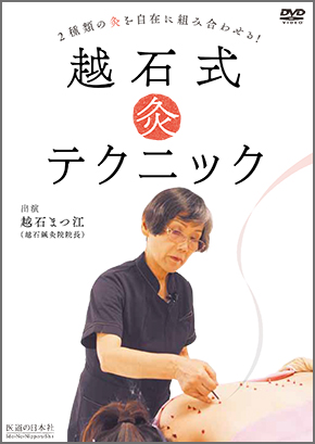 越石式 灸テクニック　2種類の灸を自在に組み合わせる！